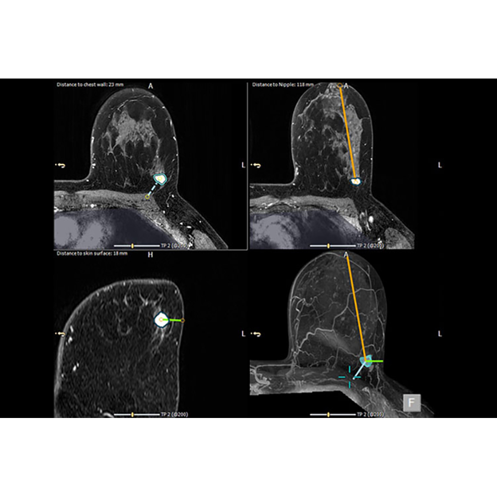 Invivo DynaCAD Breast Invivo DynaCAD Breast